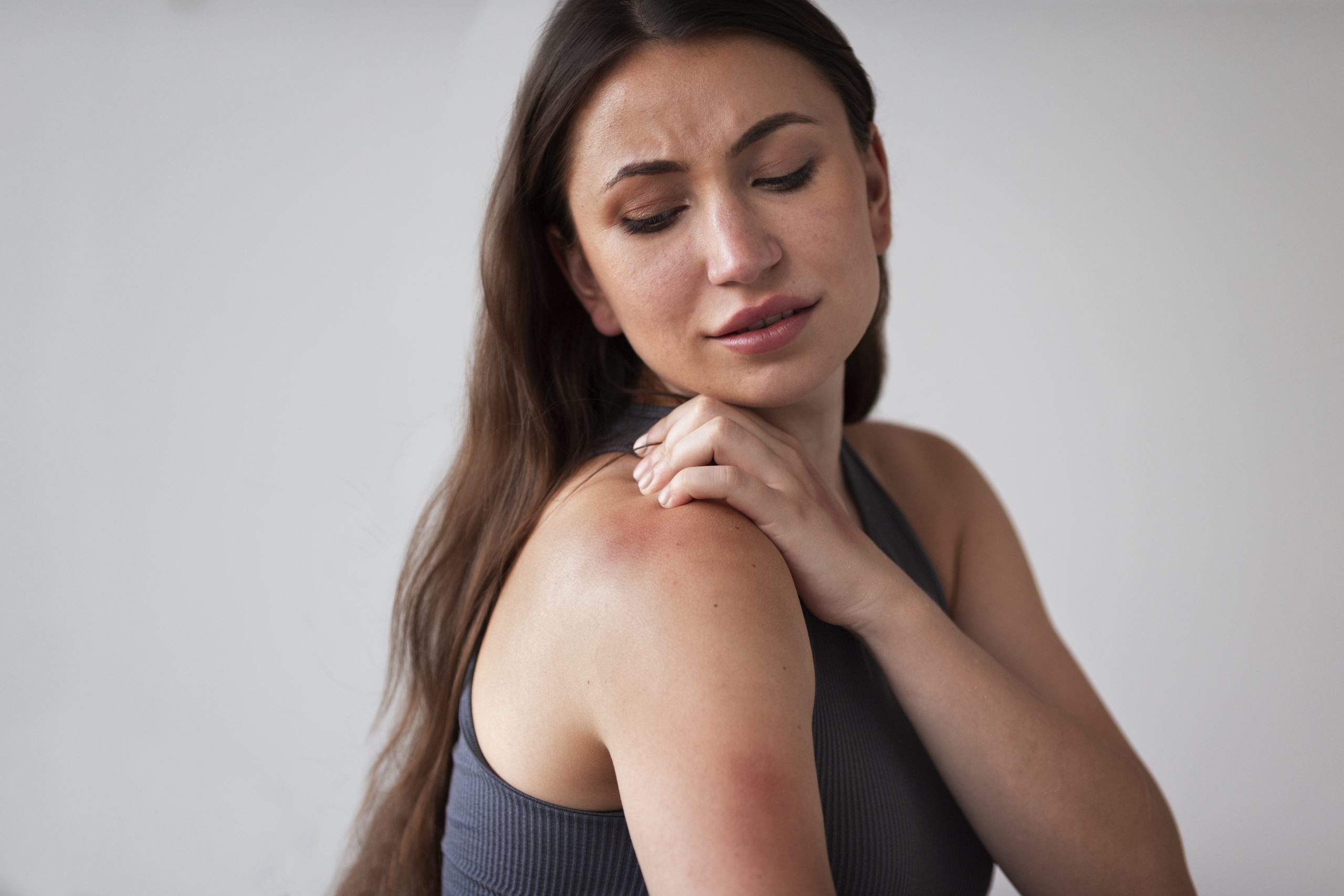 Mahisha-Siddha-Varma-Clinic-woman-suffering-from-rash-treatment-scaled